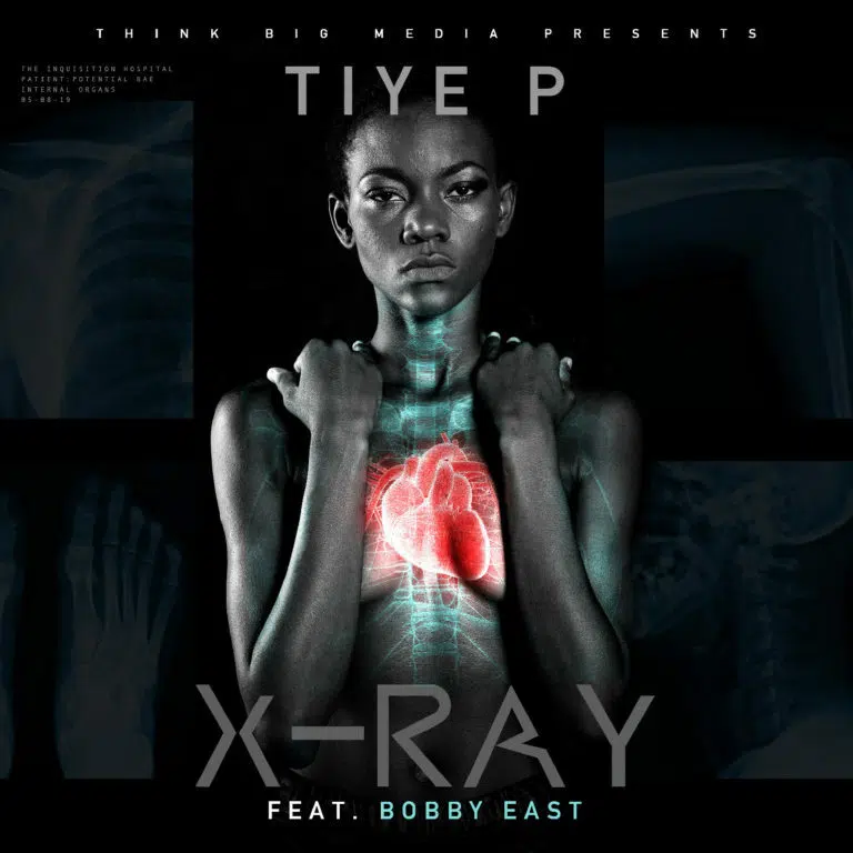 DOWNLOAD: Tiye P X Bobby East – “X Ray” Mp3