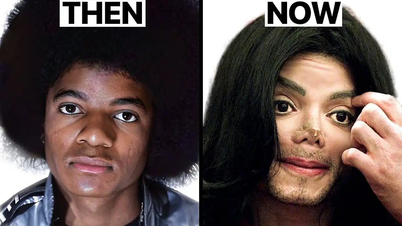 Michael Jackson Nose Job Plastic Surgeries – Surgeon Reacts